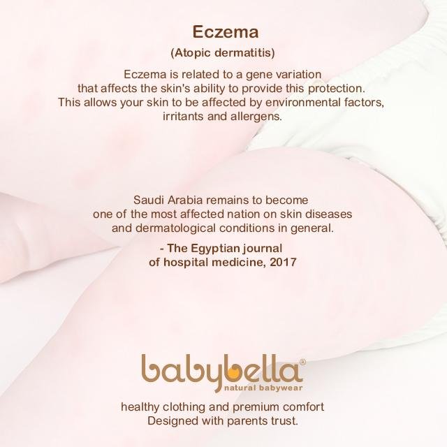 Atopic Dermatitis | BabyBella Natural Babywear
